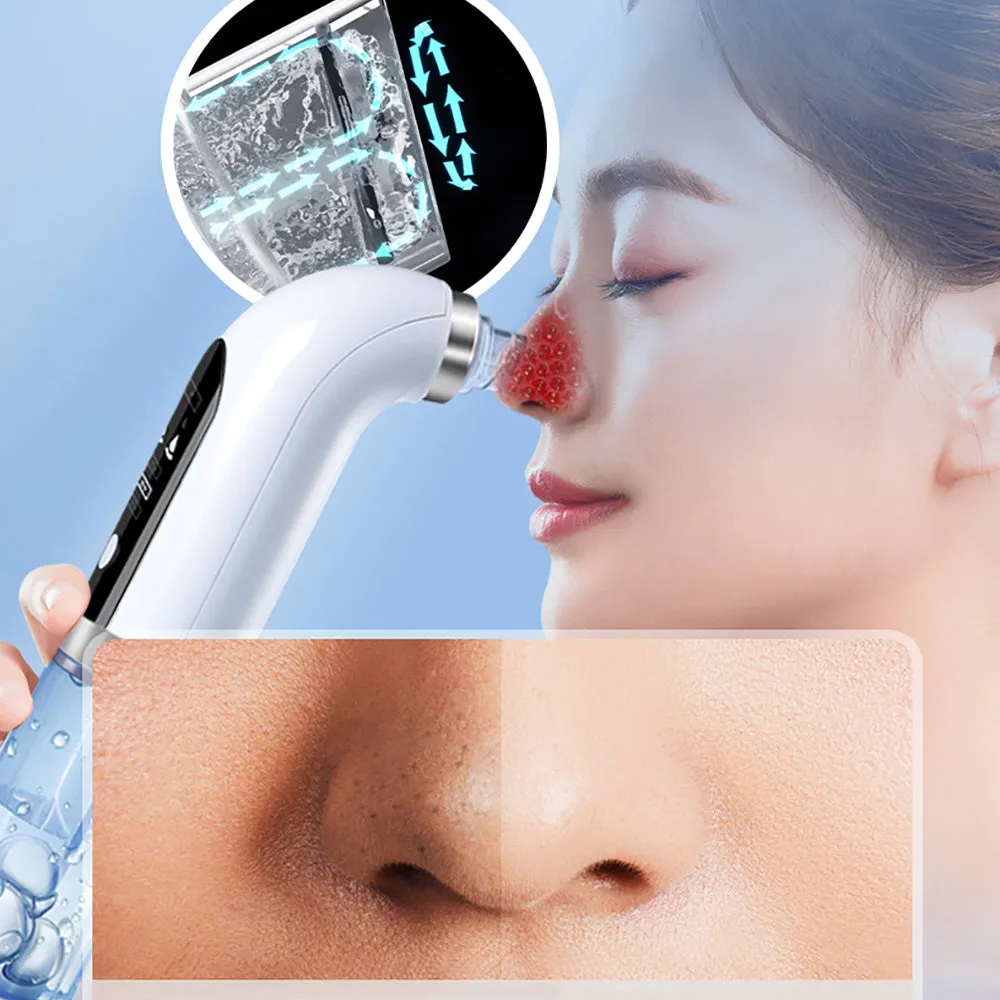 Blackhead Remover Vacuum Suction Pore Cleaner USB Facial Hydrodermabrasion